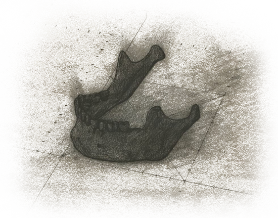 Jaw