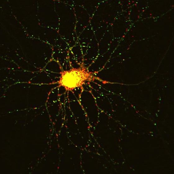 Brain-tracker-neuron-synapses-red-green-socal