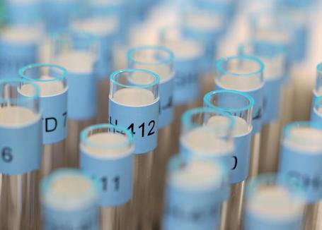 Anti-doping samples. Photo: Alex Livesey/Getty.